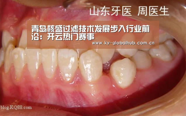 青岛核盛过滤技术发展步入行业前沿:开云热门赛事(图1) KAIYUN官网